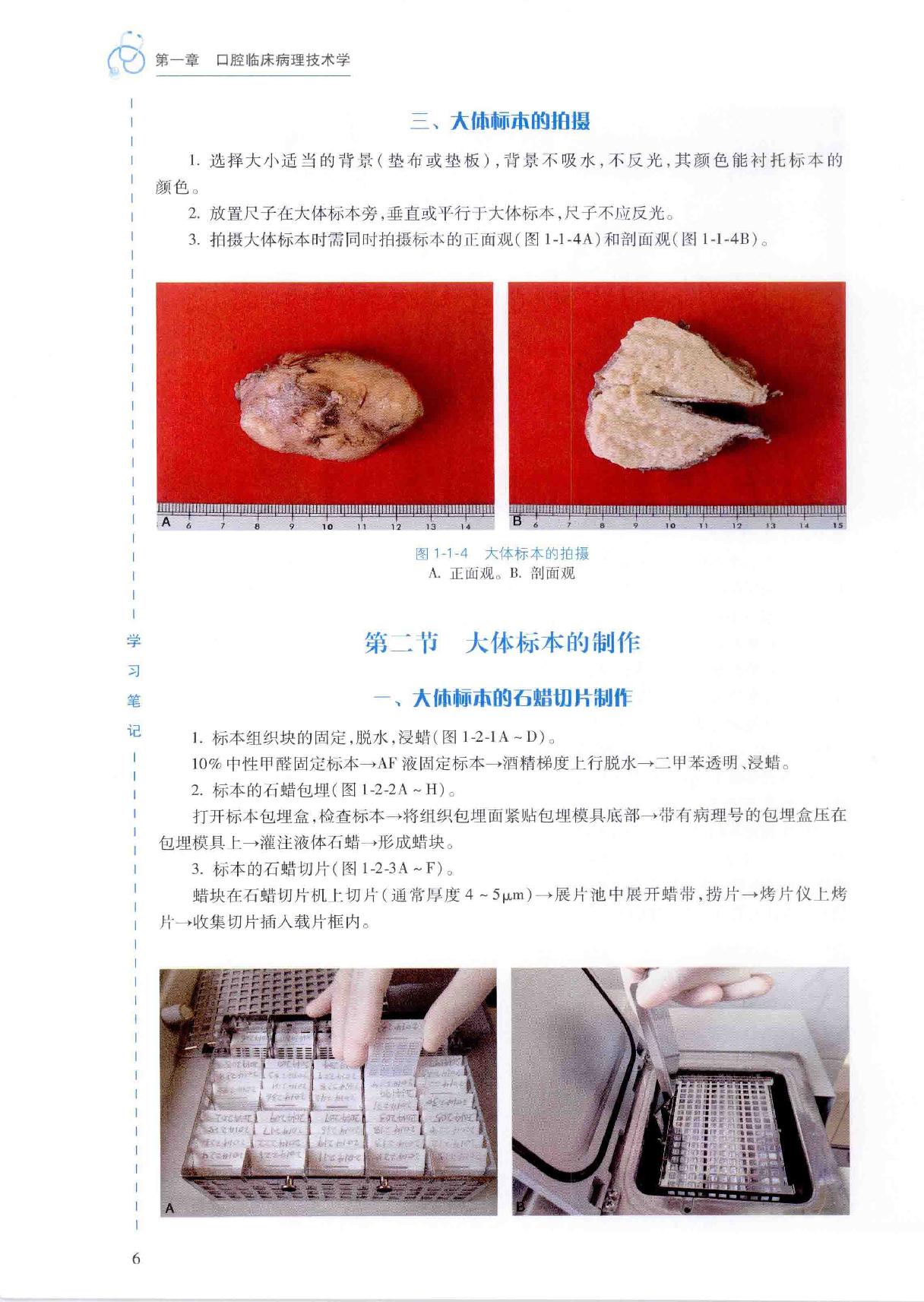 40.口腔医学 口腔病理科分册.pdf_第24页