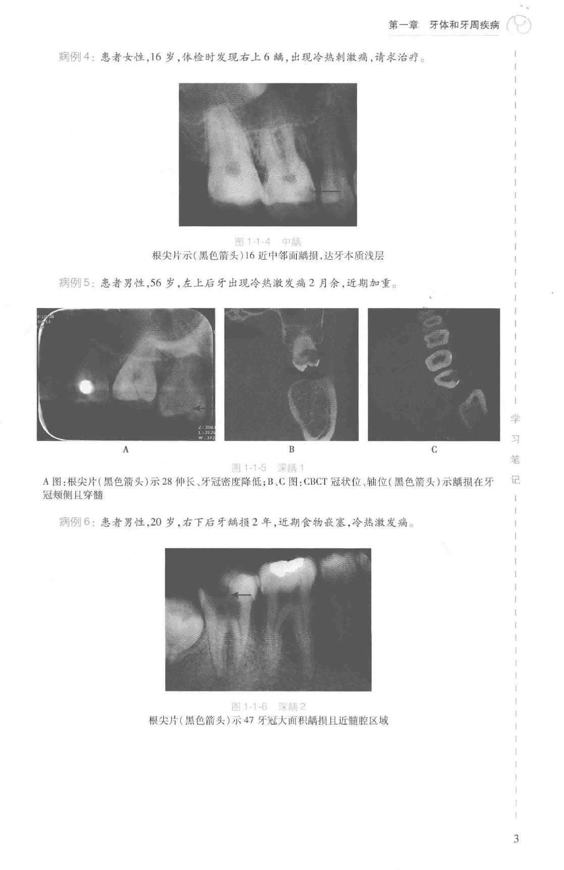 41.口腔医学 口腔颌面影像科分册.pdf_第21页