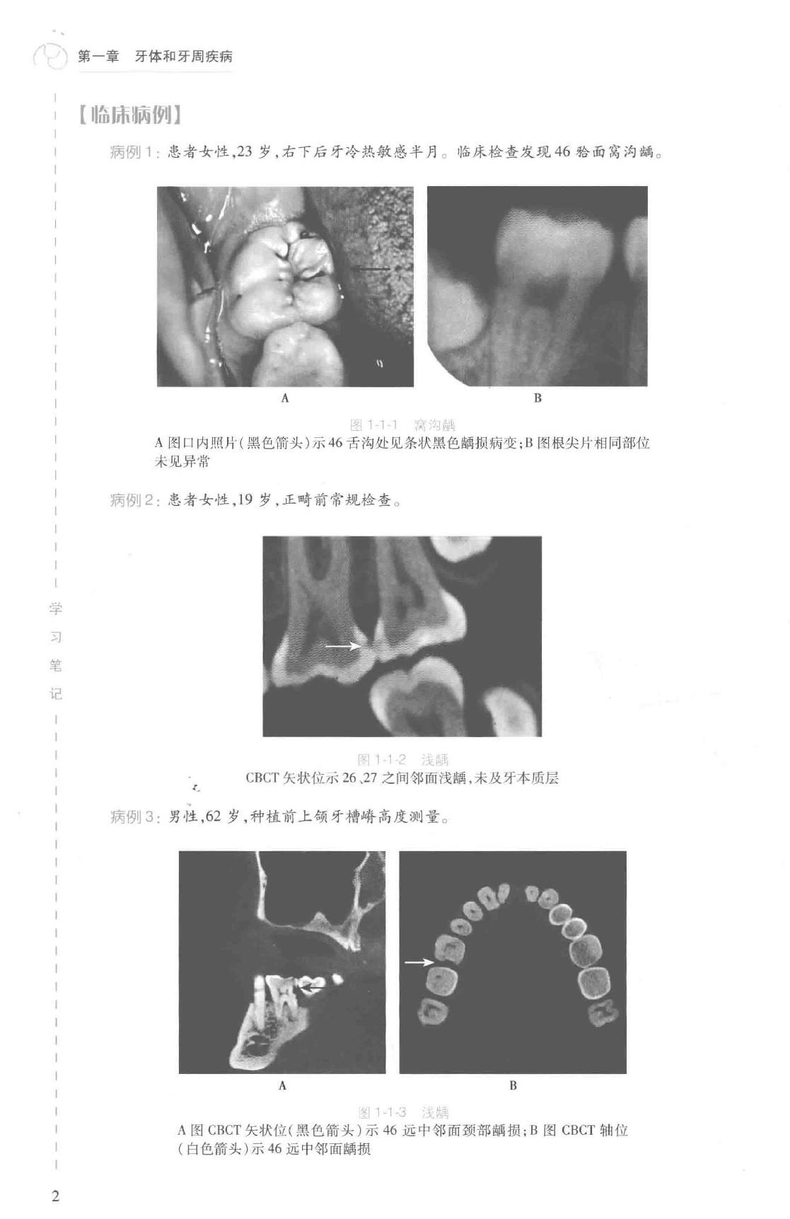 41.口腔医学 口腔颌面影像科分册.pdf_第20页