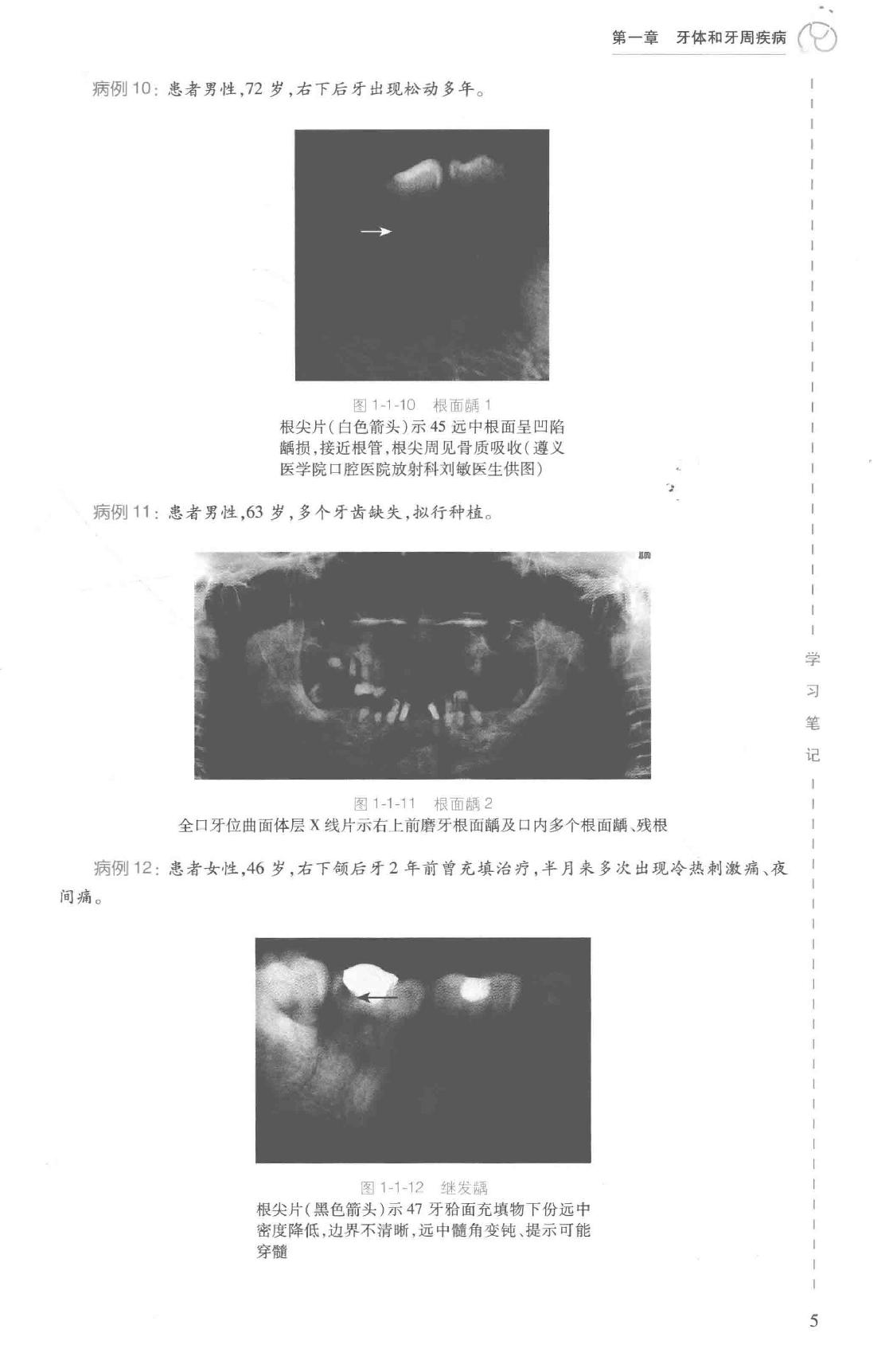 41.口腔医学 口腔颌面影像科分册.pdf_第23页