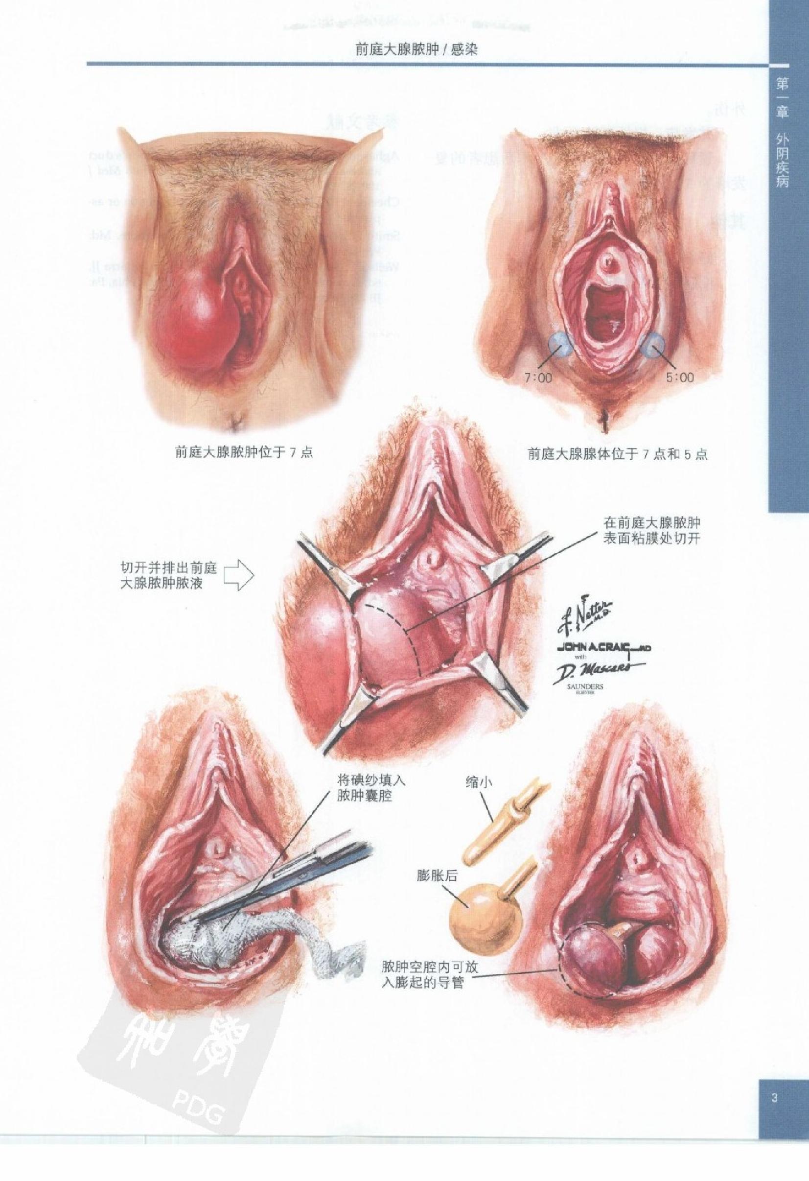 奈特妇产科彩色图谱（高清中文版）.pdf_第13页