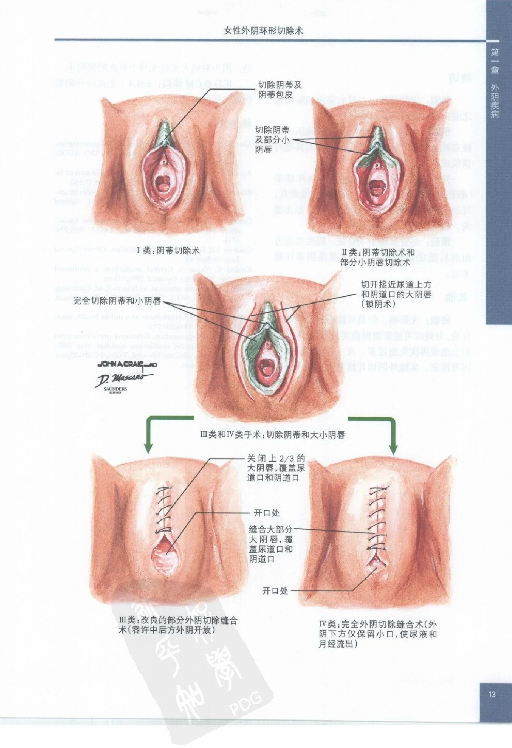 奈特妇产科彩色图谱（高清中文版）.pdf_第23页