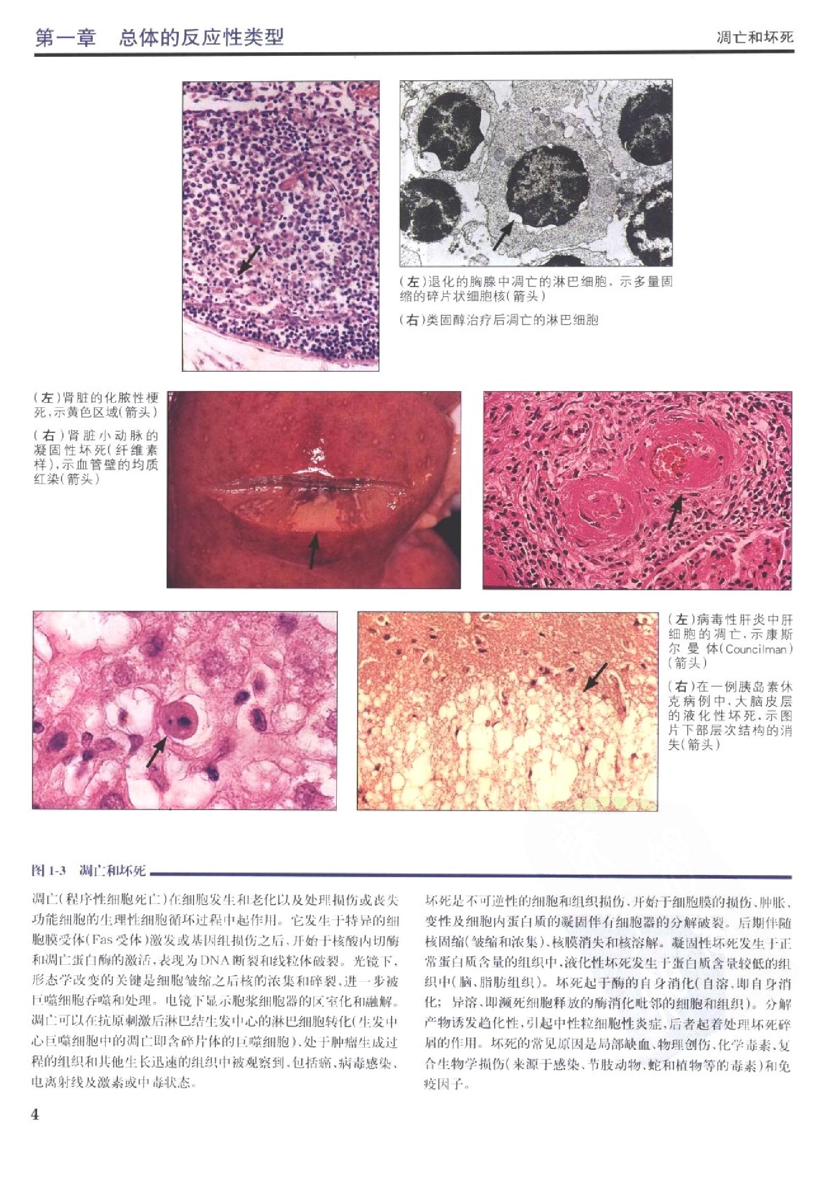 奈特病理学彩色图谱（高清中文版）.pdf_第23页