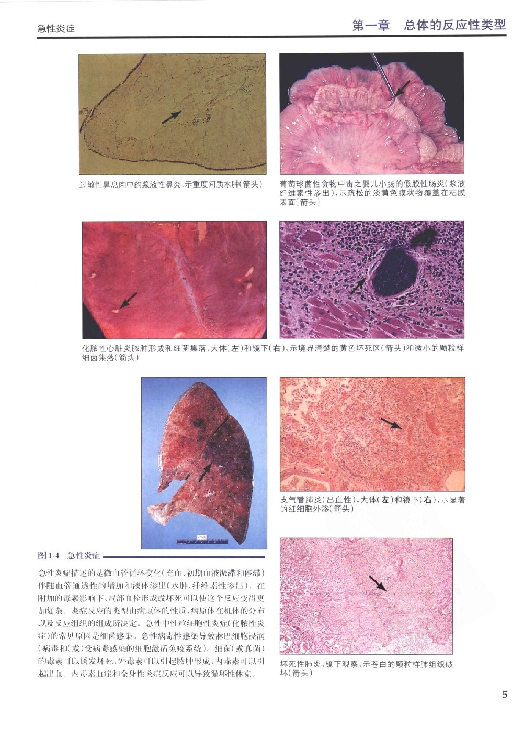 奈特病理学彩色图谱（高清中文版）.pdf_第24页