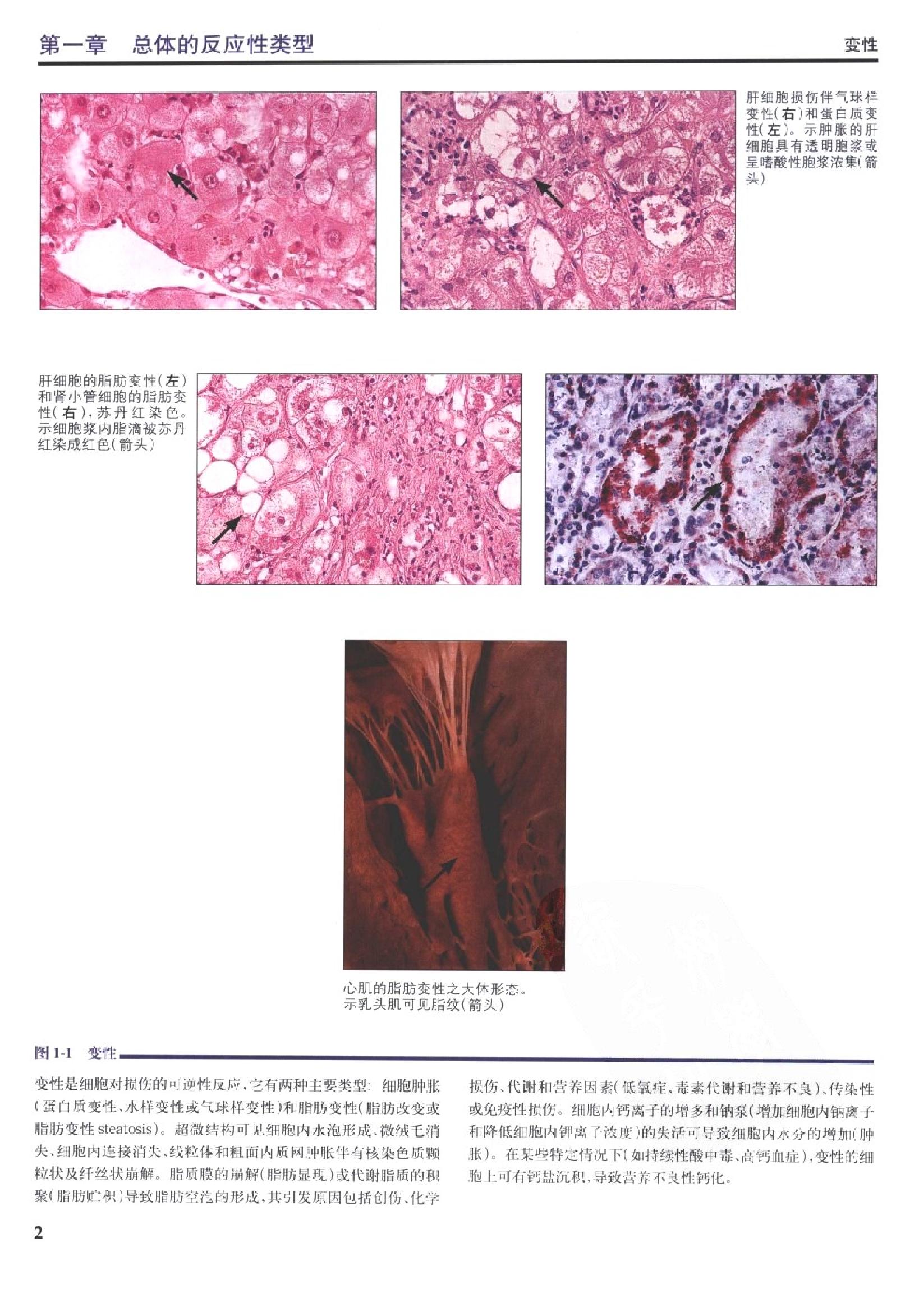 奈特病理学彩色图谱（高清中文版）.pdf_第21页