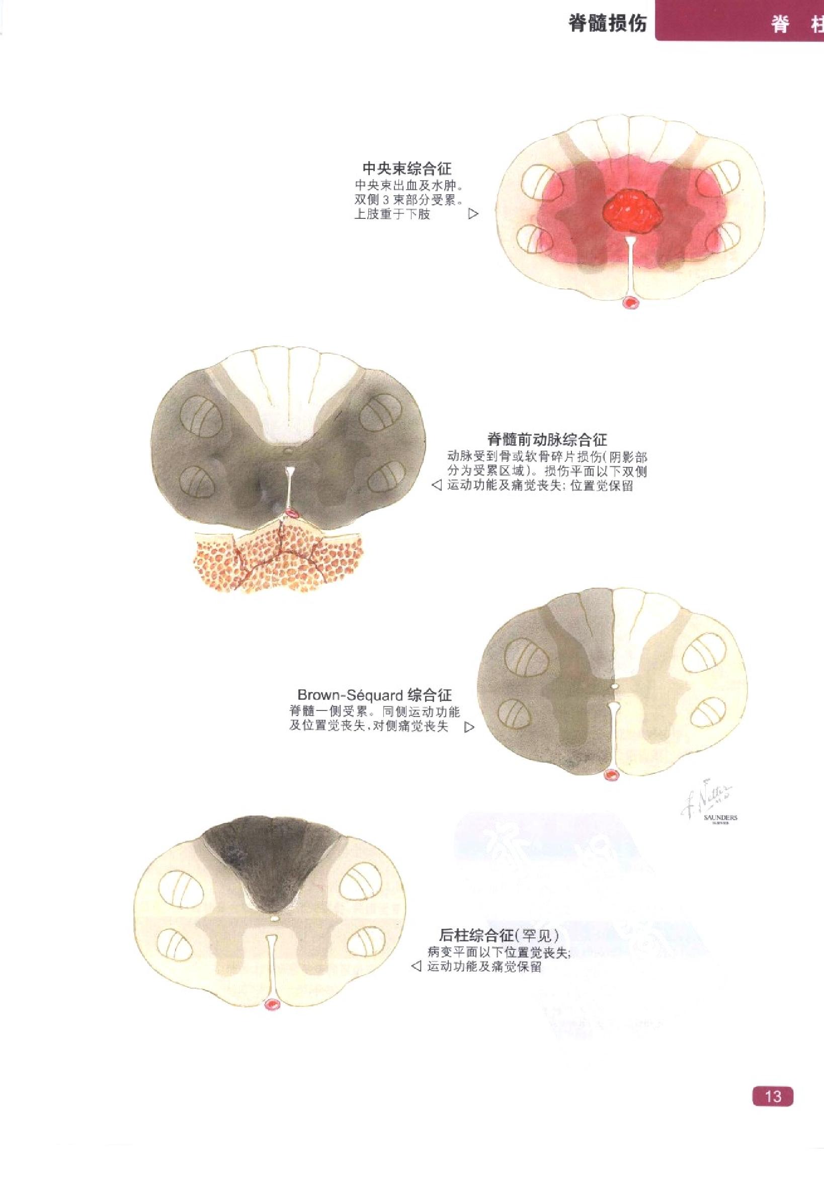 奈特简明骨科学彩色图谱（高清中文版）.pdf_第21页