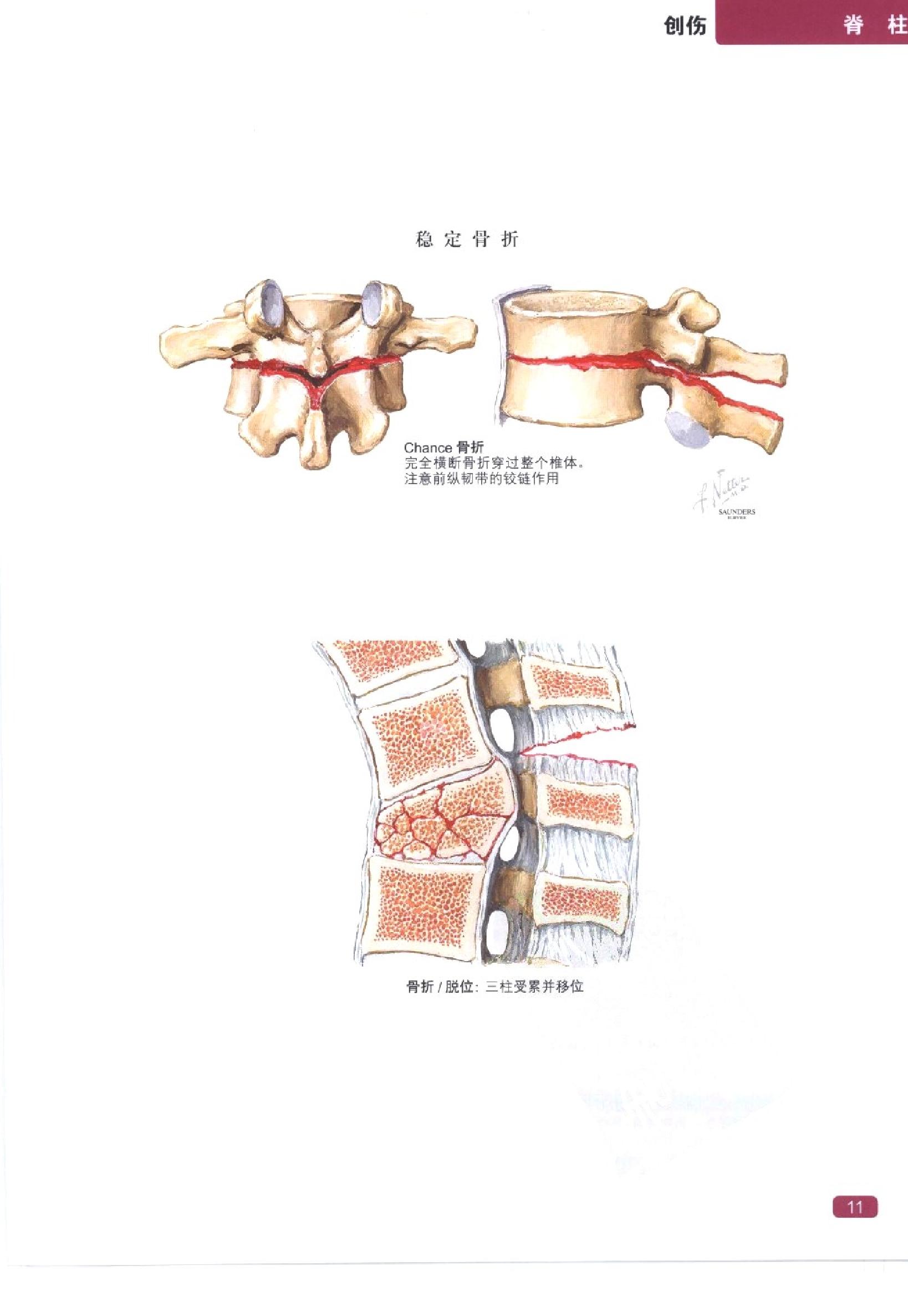 奈特简明骨科学彩色图谱（高清中文版）.pdf_第19页