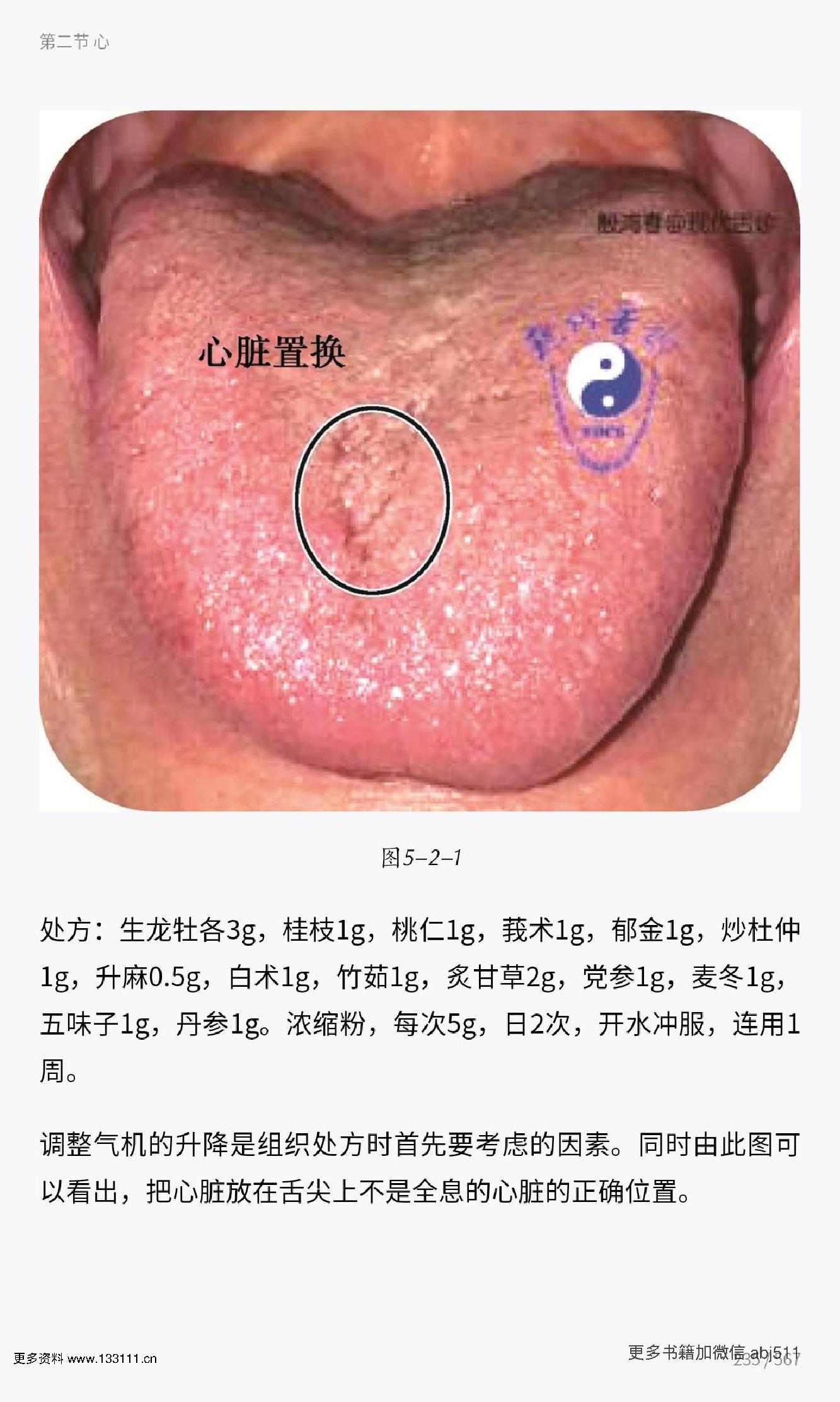 殷式舌诊.pdf_第5页