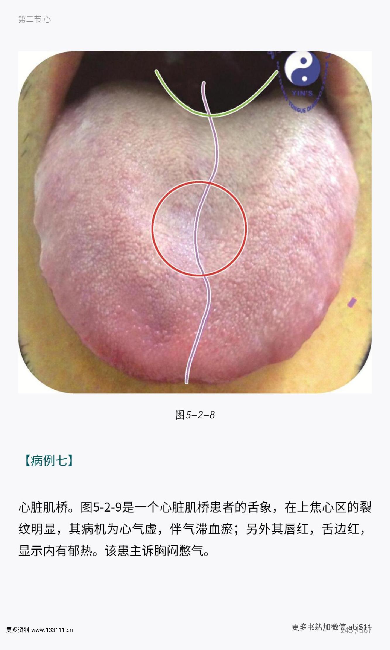 殷式舌诊.pdf_第15页