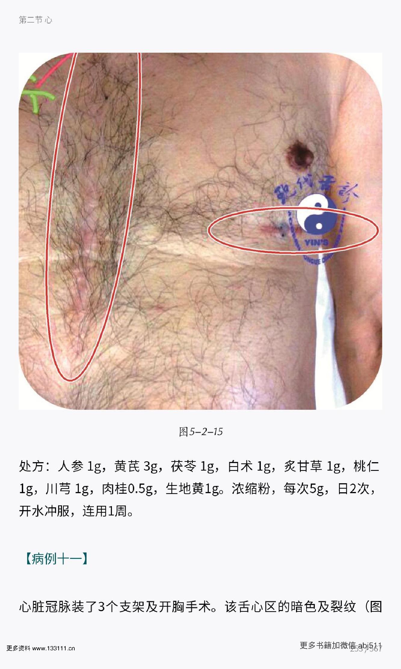 殷式舌诊.pdf_第23页