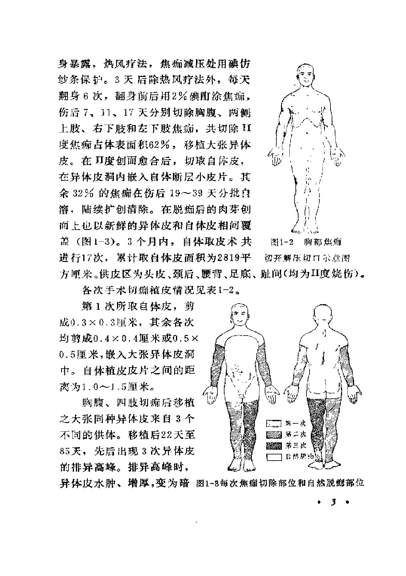 起死回生一百例——危重急症抢救经验集.pdf_第15页