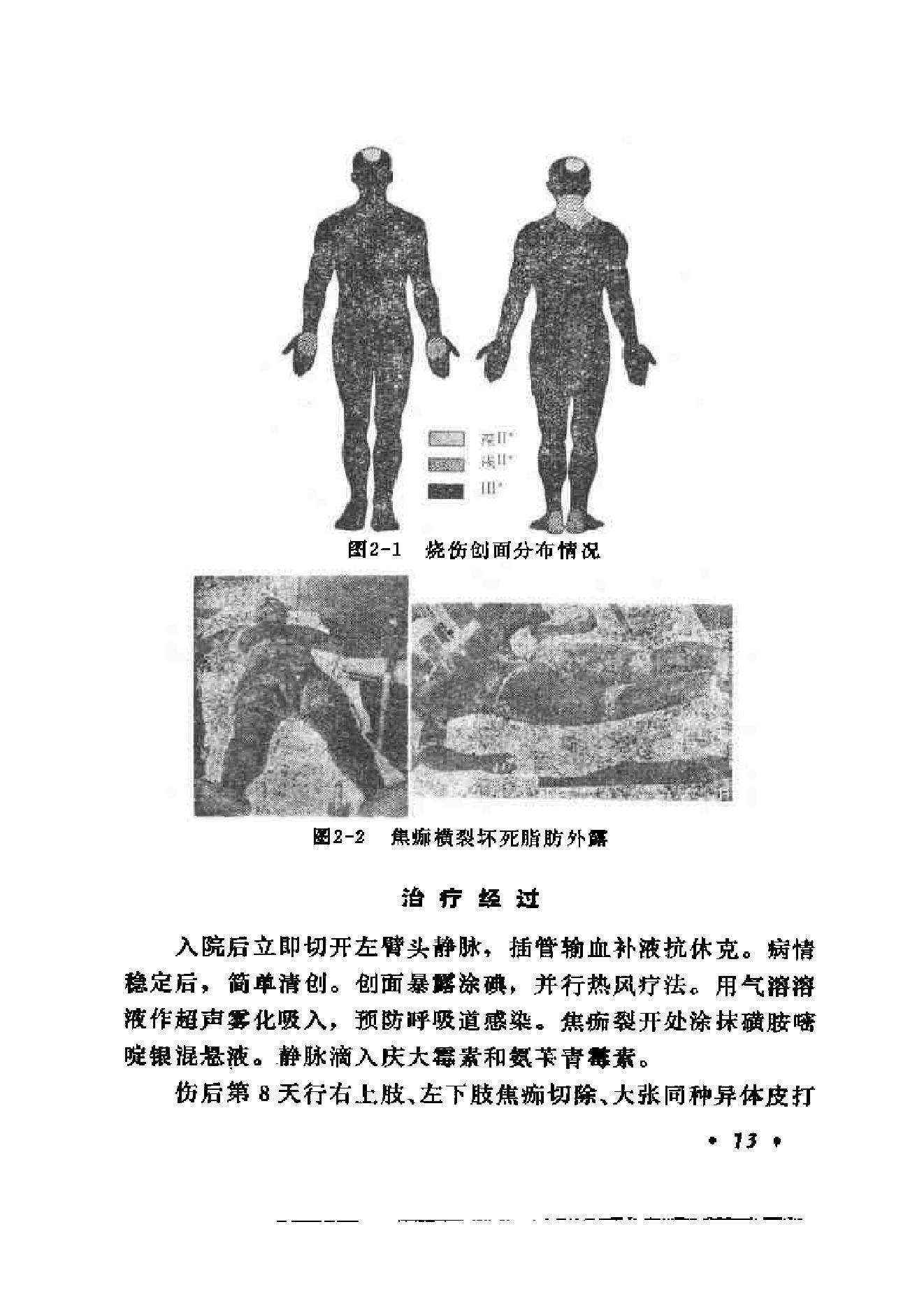 起死回生一百例——危重急症抢救经验集.pdf_第25页