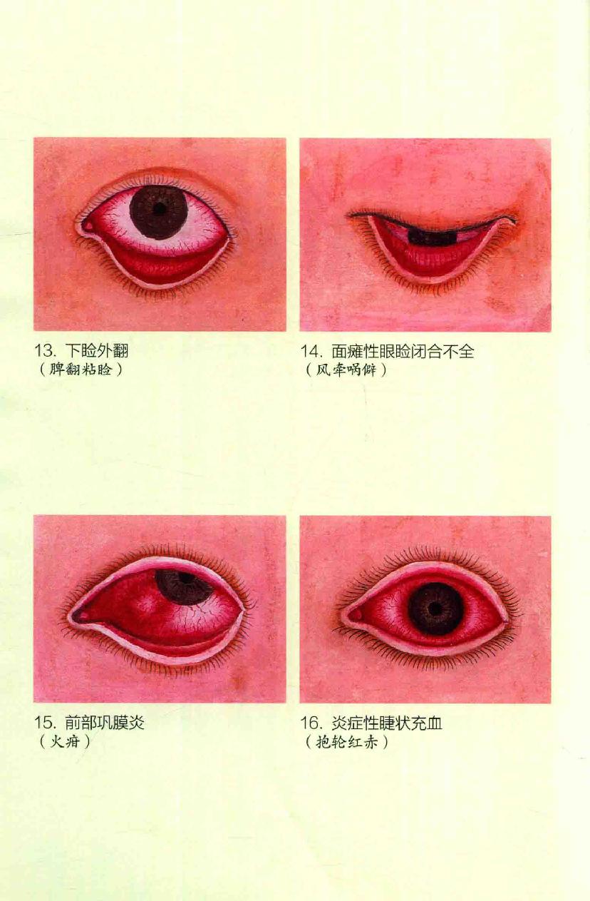 眼病治疗绝招王霖有_978-7-5132-4379-7.pdf_第8页