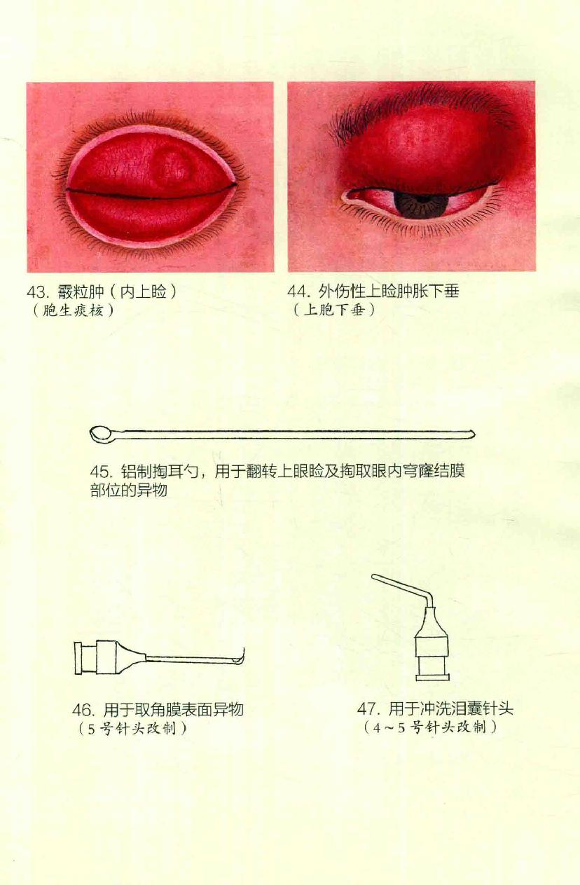 眼病治疗绝招王霖有_978-7-5132-4379-7.pdf_第15页