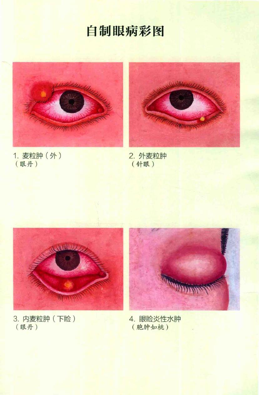 眼病治疗绝招王霖有_978-7-5132-4379-7.pdf_第5页